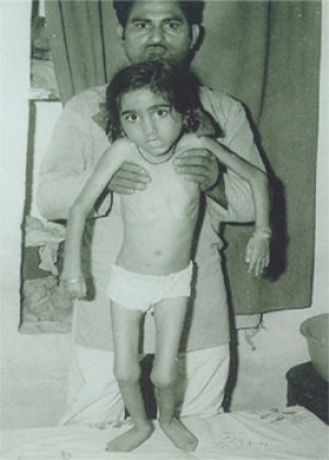 कंचन-kanchan