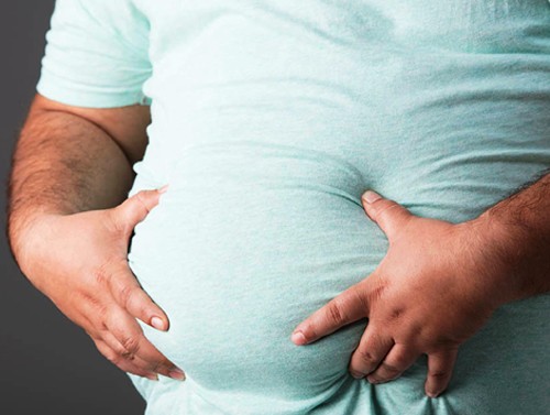 obesity